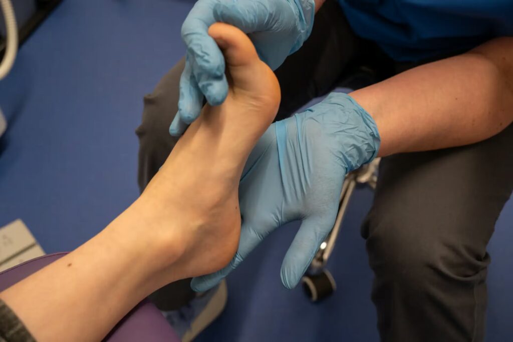 Achilles Pain 1 DSC05322 2