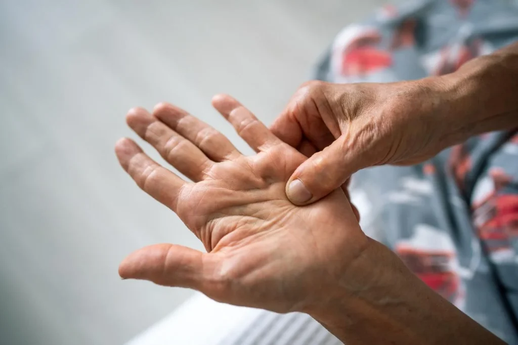 Dupuytrens Contracture Could Shockwave Therapy Be an Option