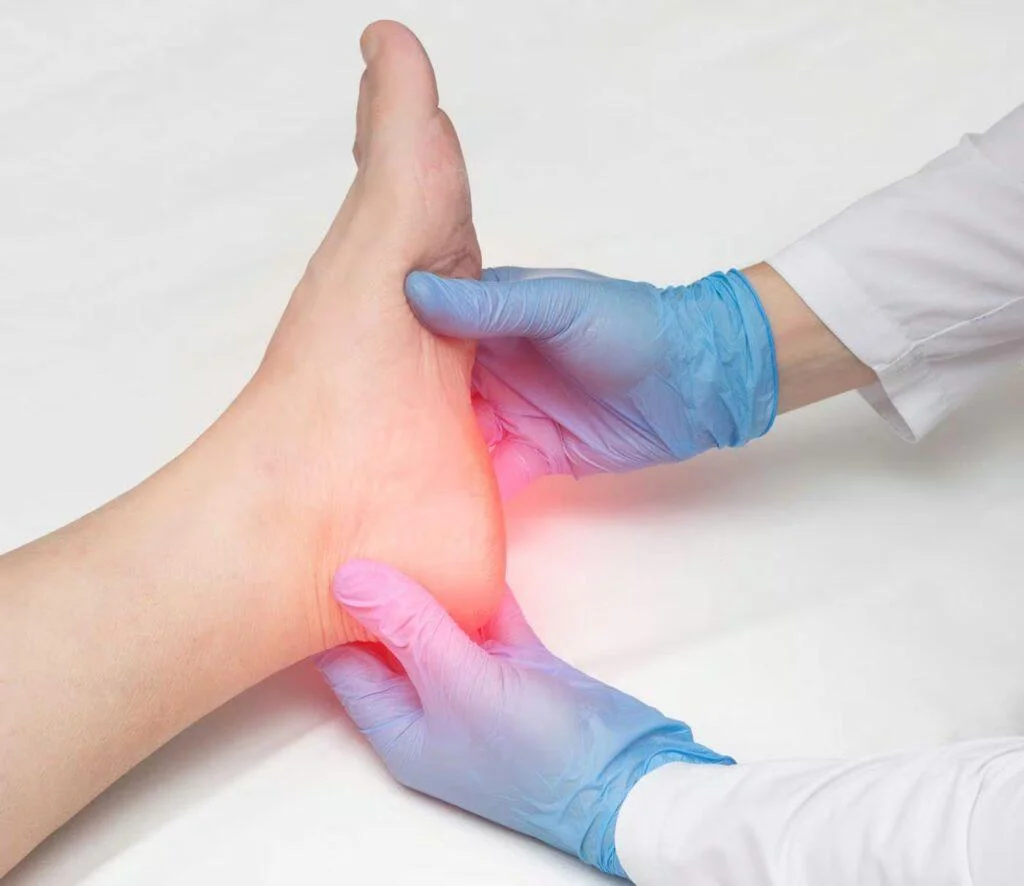 Why Does My Heel Hurt It Isnt Always Plantar Fasciitis
