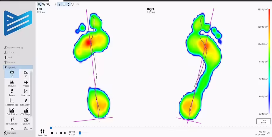 gait assesment
